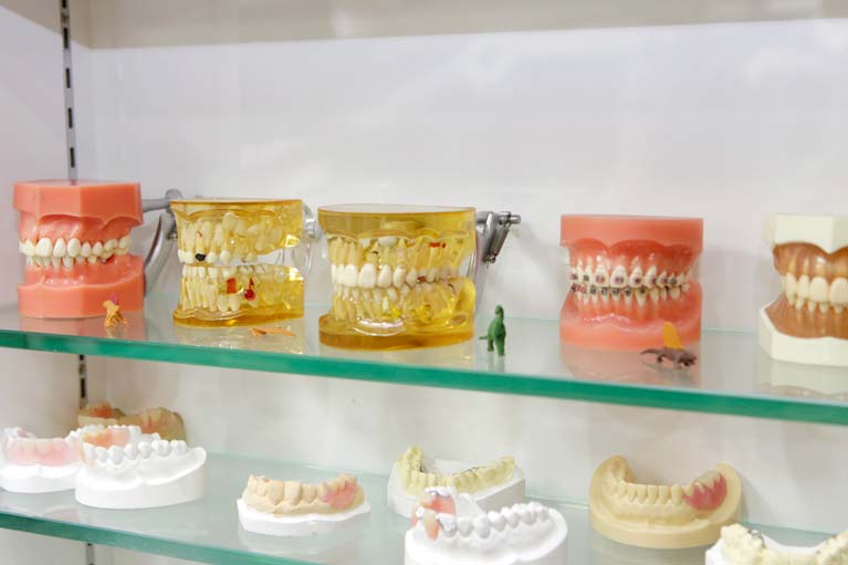 3.歯の寿命を縮めない入れ歯・ブリッジを提供します